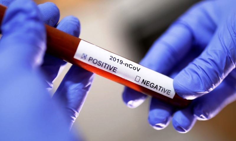 Fake News – Disseminação sobre coronavírus preocupa especialistas