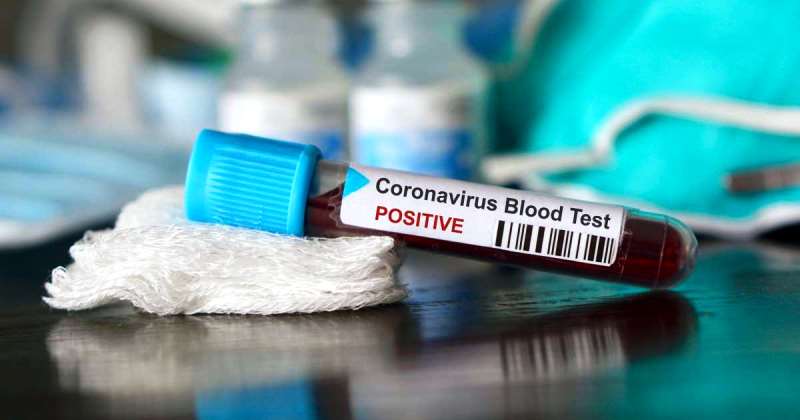 Brasil encerra abril com 5.901 mortes e 85.380 casos de coronavírus