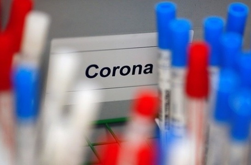 Araraquara tem 190 casos confirmados de coronavírus