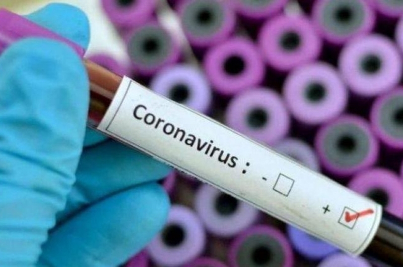 Casos confirmados de coronavírus sobem para 418 em São Carlos