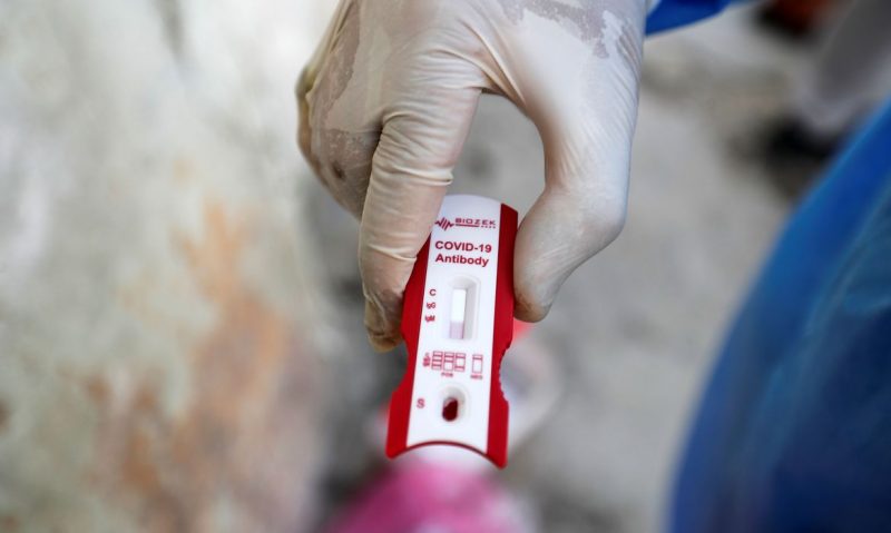 Governo anuncia parceria para vacina contra Covid-19
