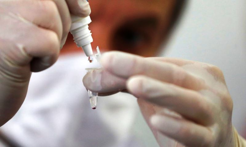 Estado de São Paulo registra 73 mortes por coronavírus em 24 horas
