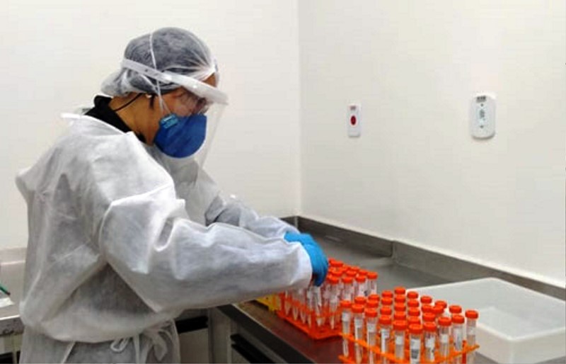 Laboratório do Instituto Biológico inicia diagnósticos para Covid-19