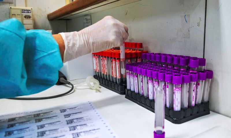 UFRJ inicia ensaios clínicos com a vacina BCG