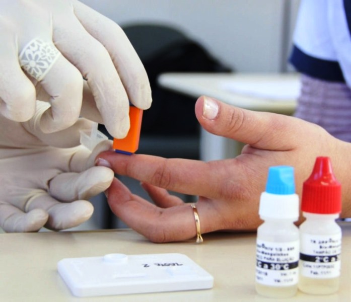 Testes rápidos de HIV e Sífilis poderão ser realizados