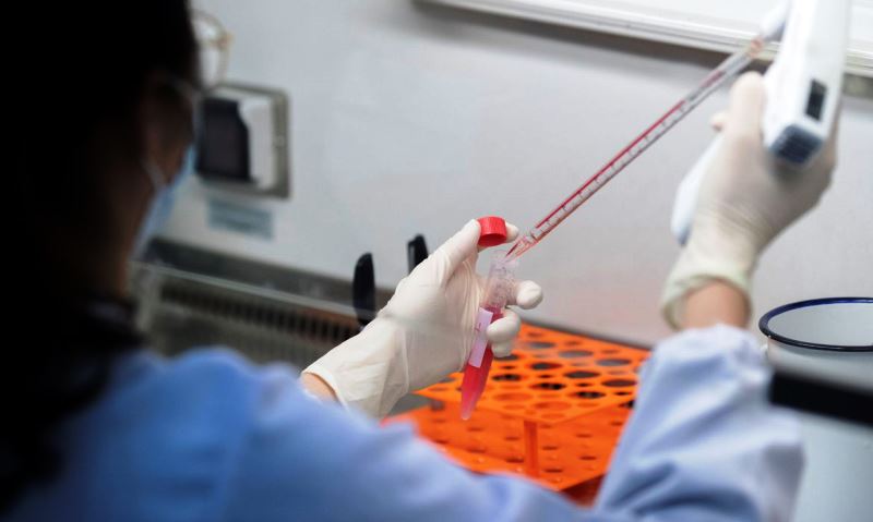 Cientistas já testam remédio anticovid e Brasil irá iniciar análise de dois soros