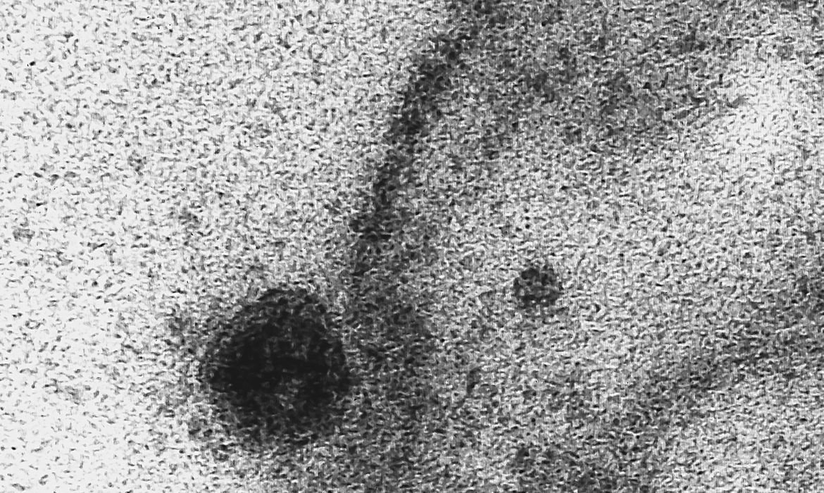Novo coronavírus infecta e se replica em glândulas salivares