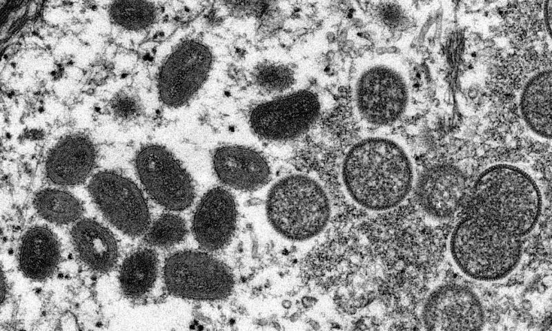 Fiocruz conclui sequenciamento genético do vírus Monkeypox