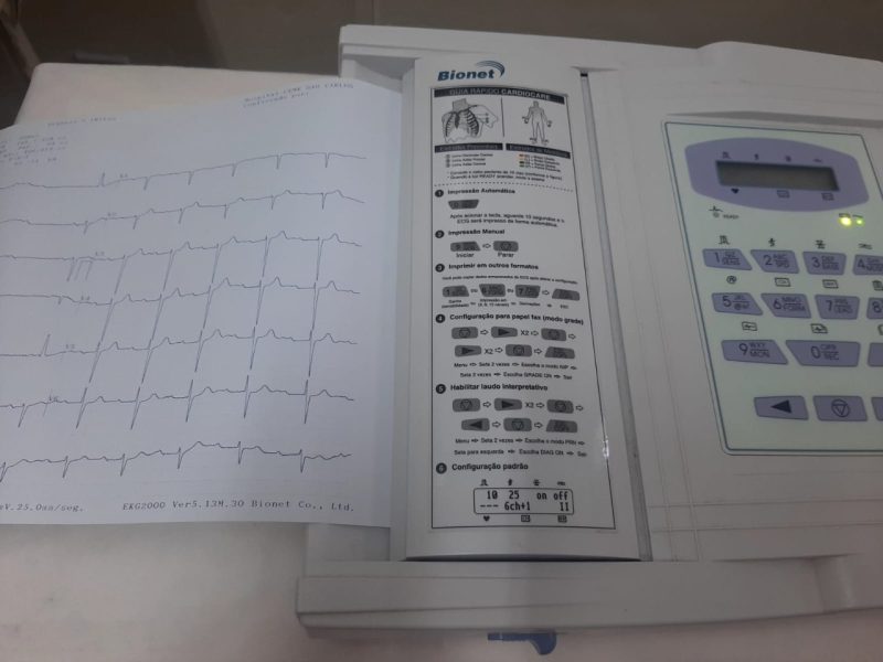 Prefeitura realizou mutirões de Eletrocardiograma