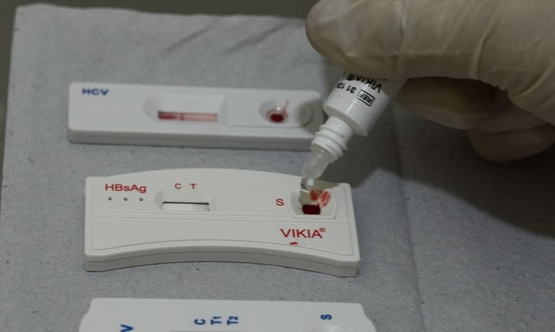 São Paulo tem 30 mil cadastrados para profilaxia pré-exposição ao HIV