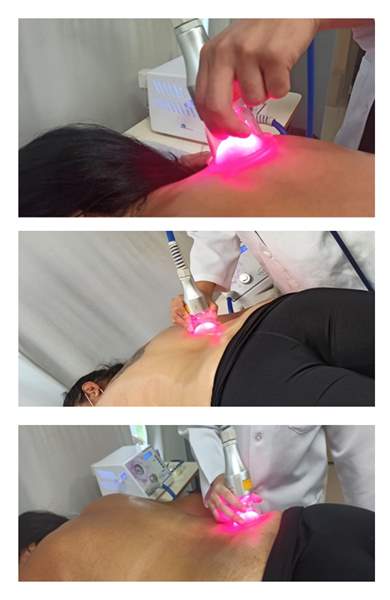 Tratamento com Laser para dores nas costas