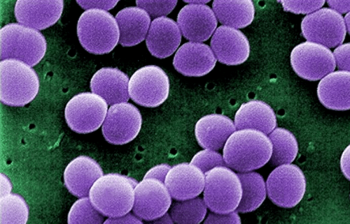 Trabalho Científico da Equipe do CEPOF – INCT – IFSC – USP no combate a bactérias resistentes é destaque na American Physical Society